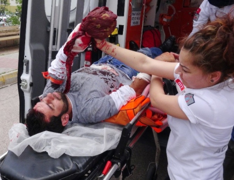 Alkollü Arkadaşlar Birbirini Yaraladı