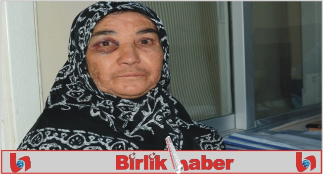 55 Yıldır Kocasından Dayak Yiyen Kadın Hastanelik Oldu