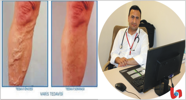 Dakikalar İçinde Varis’e Son