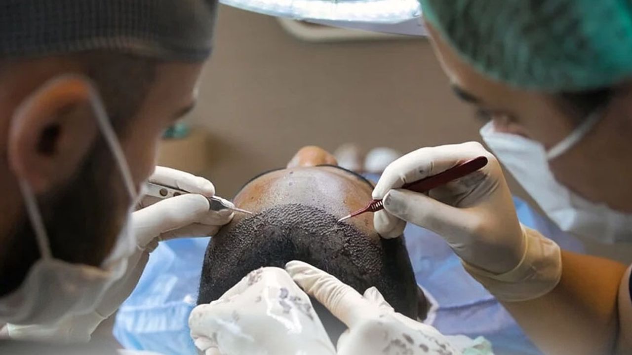 Sağlık Bakanlığı’ndan saç ekimi birimlerinde yeni dönem