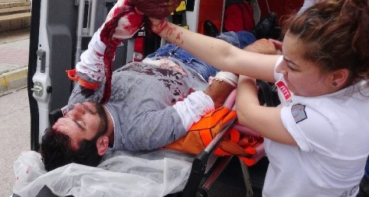 Alkollü Arkadaşlar Birbirini Yaraladı