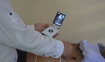 Aksaray Devlet Hastanesine El ekosu getirildi