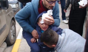 Çocuğa Otomobil Çarptı