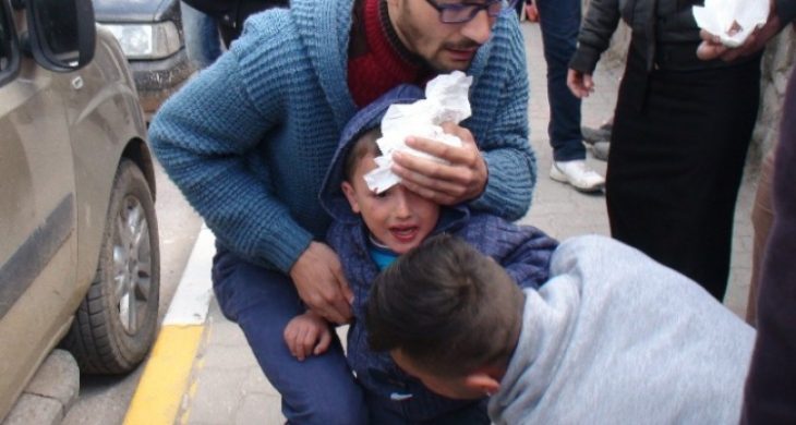 Çocuğa Otomobil Çarptı