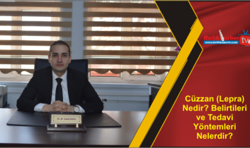 Cüzzan (Lepra) Nedir? Belirtileri ve Tedavi Yöntemleri Nelerdir?