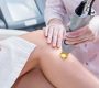 Lazer Epilasyon nedir?