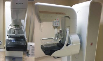 Meme kanseri teşhisinde ileri teknoloji