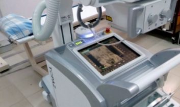 Aksaray Devlet Hastanesi, ileri teknolojiye sahip mobil röntgen cihazı aldı