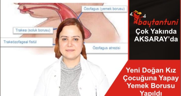 Yeni Doğan Kız Çocuğuna Yapay Yemek Borusu Yapıldı