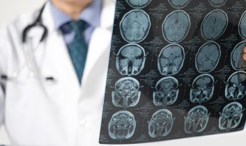 Pandemi beyni yaşlandırdı: Covid olmasanız bile etkilenmiş olabilirsiniz