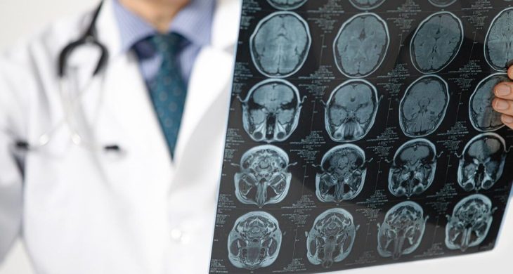 Pandemi beyni yaşlandırdı: Covid olmasanız bile etkilenmiş olabilirsiniz