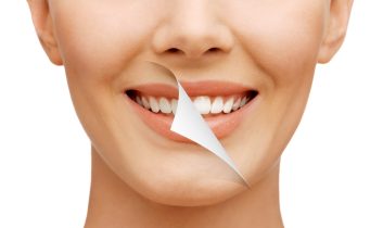 Dişlerinizi Ne Sıklıkla Beyazlatmalısınız?