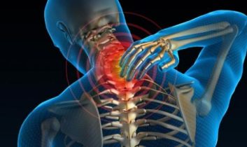 Boyun Fıtığı Olanlar Bunlara Dikkat Etmezse Cerrahi Kaçınılmaz Olur