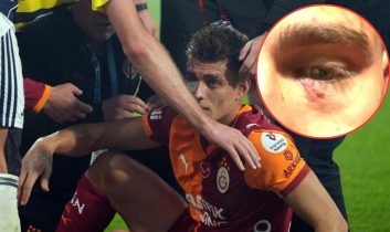 Derbide sahaya çakmak atan taraftar gözaltına alındı