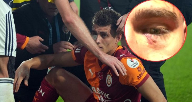 Derbide sahaya çakmak atan taraftar gözaltına alındı