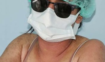 Van’da “Cilt Beyazlatıcı” kremi kullanan genç kız yoğun bakımda hayatta kaldı