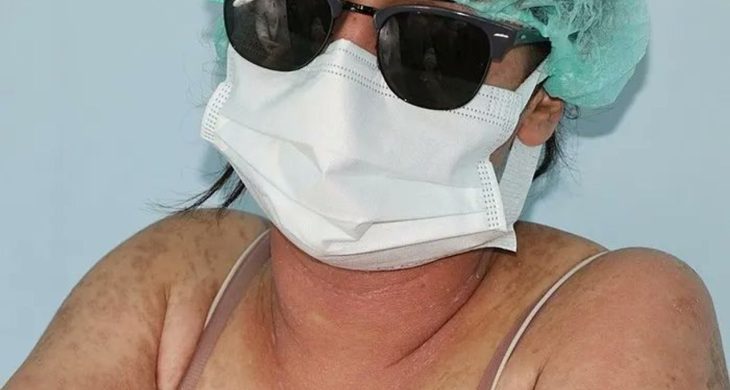 Van’da “Cilt Beyazlatıcı” kremi kullanan genç kız yoğun bakımda hayatta kaldı