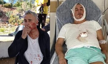 U14 maçı sonrası şiddet iddiası: Veli hastanede