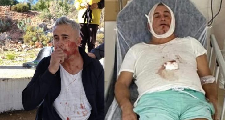 U14 maçı sonrası şiddet iddiası: Veli hastanede