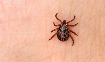 Kayseri’de KKKA şüphesiyle tedavi gören bir kişi hayatını kaybetti