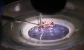 Kene vakalarında artış neden yaşanıyor? uzmandan kritik uyarılar
