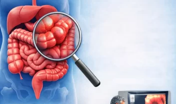 Kolorektal kanserde erken tanı ve ücretsiz tarama