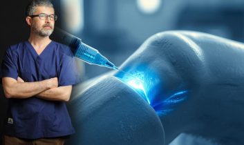 Prof. Dr. Ahmet Karacalar uyardı: Lipödem diz sağlığını tehdit ediyor