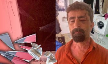 Kayınpederini cam parçalarıyla kesti