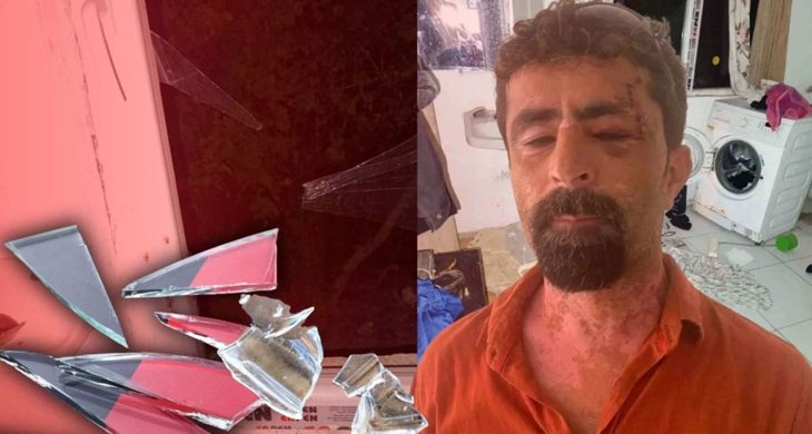 Kayınpederini cam parçalarıyla kesti