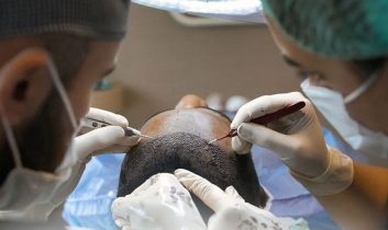 Sağlık Bakanlığı’ndan saç ekimi birimlerinde yeni dönem