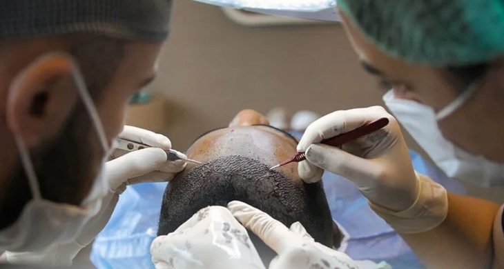 Sağlık Bakanlığı’ndan saç ekimi birimlerinde yeni dönem