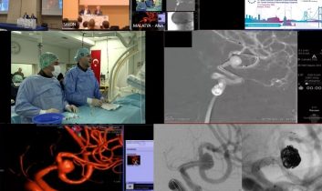 Malatya’dan dünyaya tıbbi başarı: Beyin baloncuğu tedavisi canlı yayında yapıldı